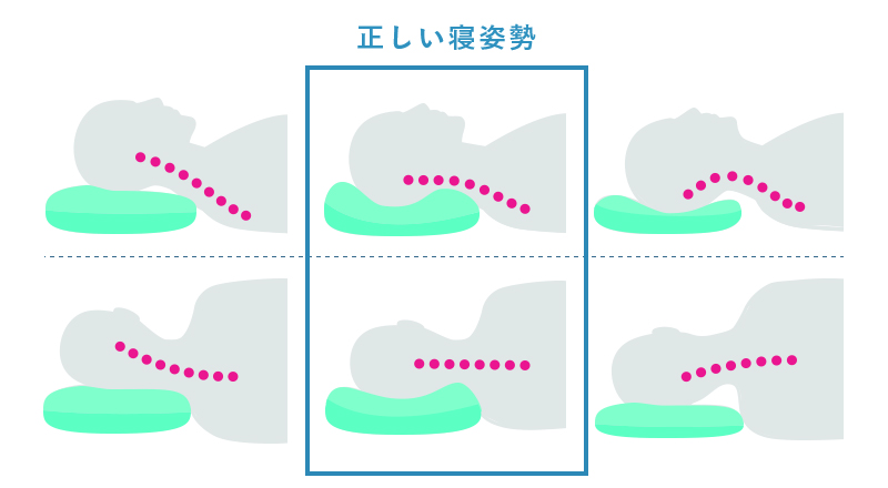 寝違え