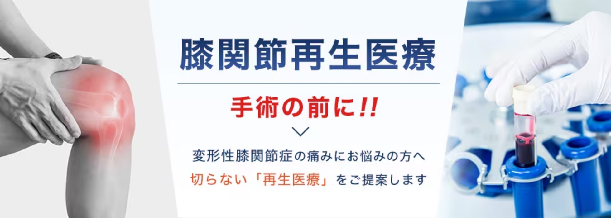 膝関節再生医療 TOP