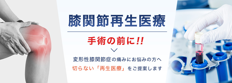 変形性膝関節症の痛みにお悩みの方へ切らない「再生医療」をご提案します
