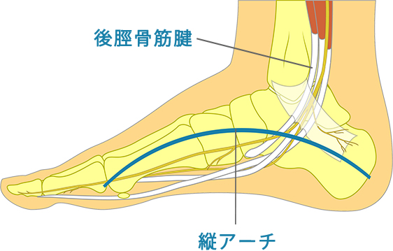 成人期扁平足