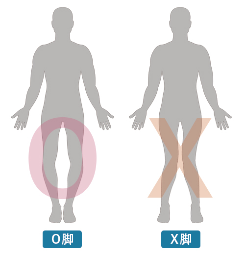 O脚・X脚