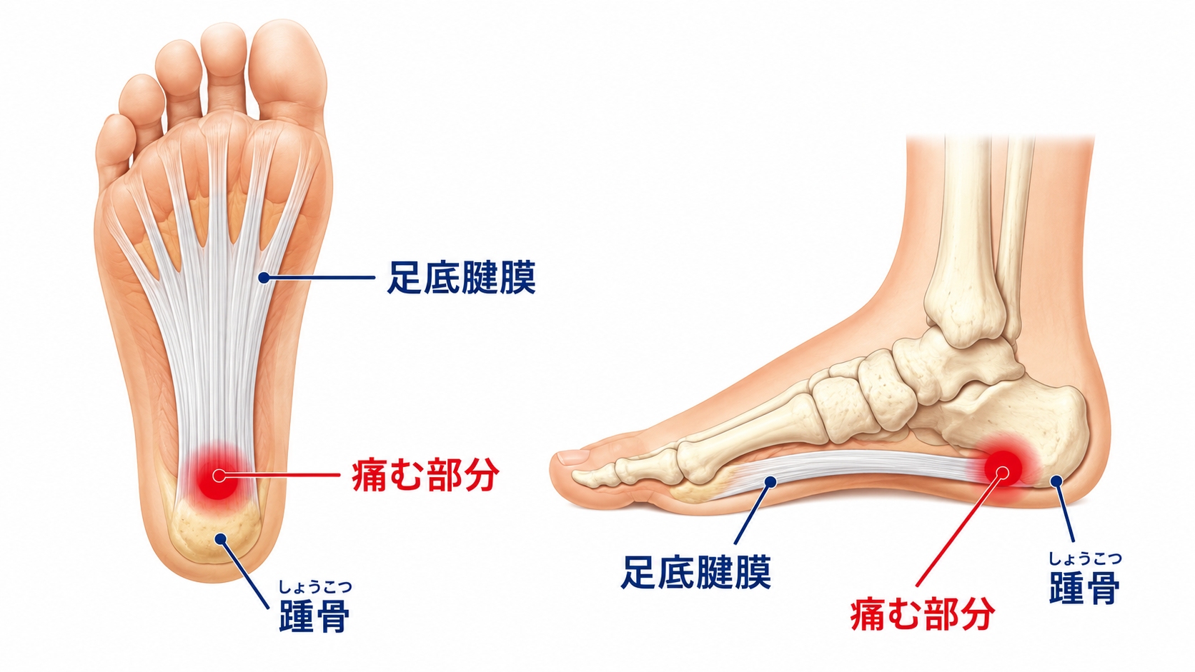 足底筋膜の構造