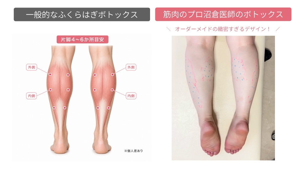 診察室で整形外科医が患者のふくらはぎを診察し、マーカーでデザインしている様子