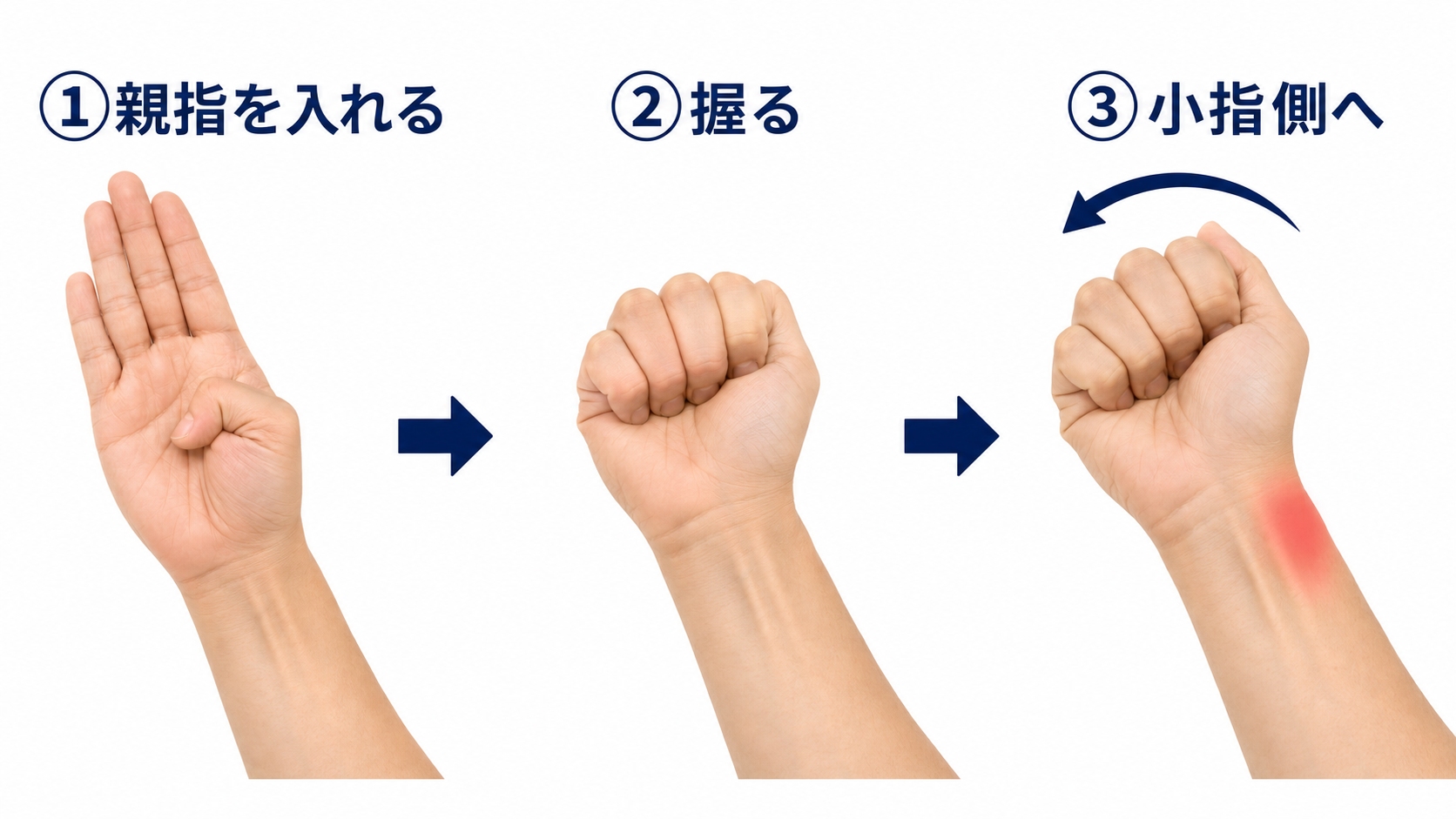 フィンケルシュタインテストの手順