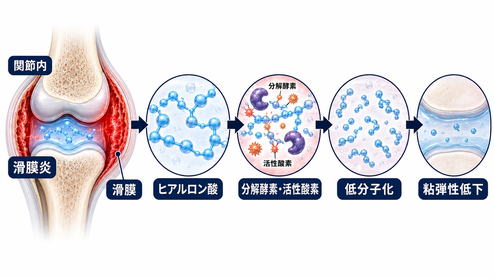 ヒアルロン酸が早期分解されるメカニズム