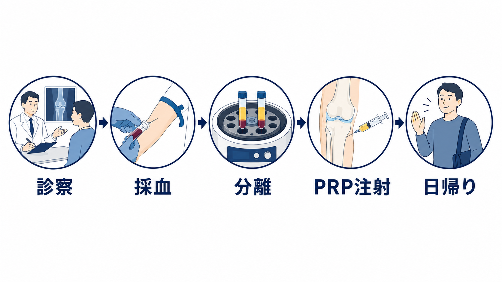 日帰りで完了するPRP療法の流れ