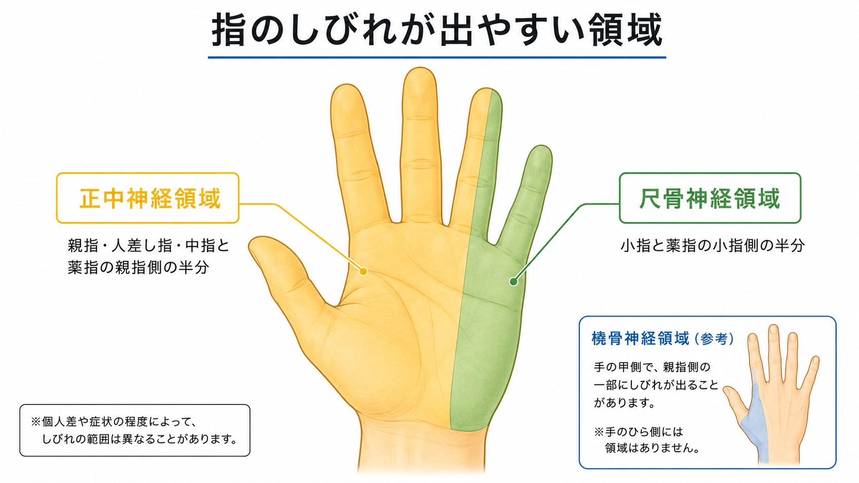 手のしびれる場所と原因となる神経の目安を示す図解