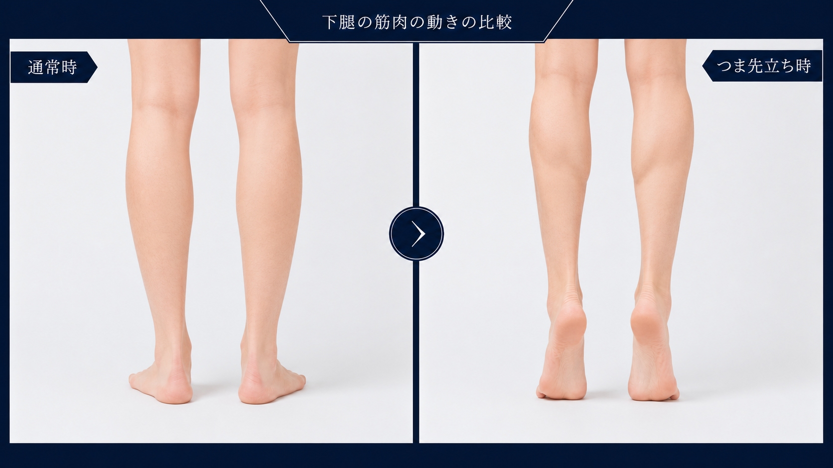 通常時とつま先立ち時のふくらはぎの筋肉の比較